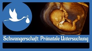 Schwangerschaft Pränatale Untersuchung [upl. by Hurwitz472]