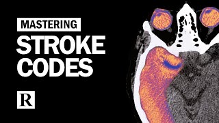 Mastering Stroke Codes [upl. by Tade]