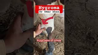 Hygroma of knee l dr Umar khan [upl. by Netaf589]