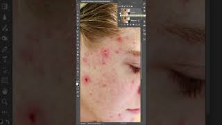 Blemish Removal and Frequency Separation AMAZING photoshop highendskinretouching photoediting [upl. by Ailerua535]