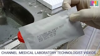 HPylori antigen rapid test in laboratoryHelicobacter pylori testHindi amp Urdu [upl. by Nynnahs]