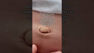 Umbilical granuloma umbilicalcord granuloma newborn baby firsttimemom firsttimeparents [upl. by Aynotahs523]