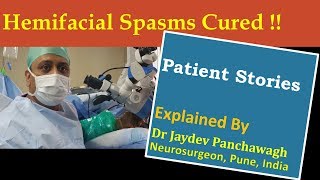 ‘Hemifacial spasms Cured’  Patient Stories explained by Dr Jaydev Panchawaghहेमिफेशियल स्पास्म [upl. by Lundt264]