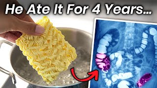 DIY Instant ramen party  instant noodles  ways to make instant ramen  instant noodle lover [upl. by Melas]