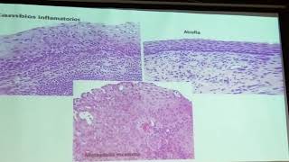 InmunoHistoquímica en Patología Cercival Dra Monica Gil [upl. by Eceertal]