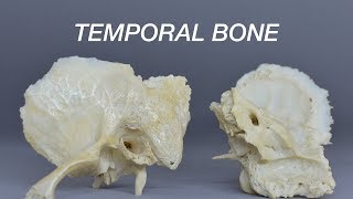 TEMPORAL BONE [upl. by Sallyanne]