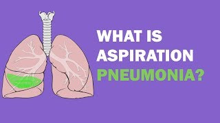 What is aspiration pneumonia [upl. by Igig]