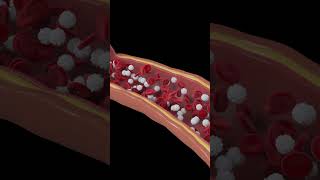 Platelets and plasma in blood [upl. by Schweiker]