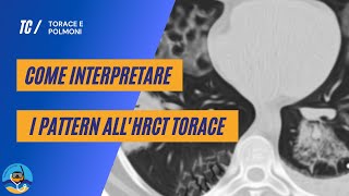 Come interpretare i pattern allHRCT torace  parte 1 [upl. by Claudell]