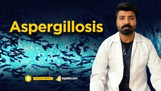 Aspergillosis  Infectious Clinical Medicine  Online Video Lectures  VLearning [upl. by Llevram42]