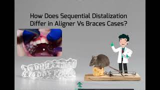 How Does Sequential Distalization Differ In Aligners Vs Braces [upl. by Aneerak863]