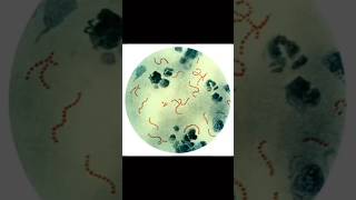 Streptococcus pyogenes [upl. by Nyral]