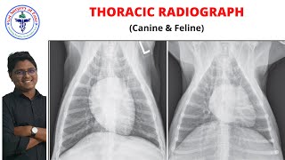 Thorax  Radiology  Lecture 02 [upl. by Thornburg]