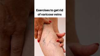 Varicose veinsdeep thrombosis exerciseleg swelling exercise [upl. by Asiulairam]