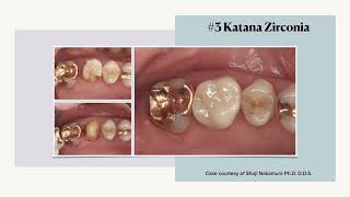 Zirconia 101 10 of 11 Clinical cases [upl. by Dove]