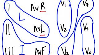 ECG Interpretation  ECG Made Easy  Coronary Artery  Location of MI  STEMI  NSTEMI [upl. by Skippy]