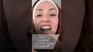 Spot the aligners  if you can🕵️justenoughstillshort [upl. by Foster]