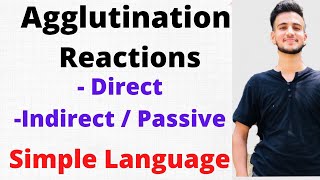 Agglutination Reaction Microbiology Agglutination Test [upl. by Stclair]