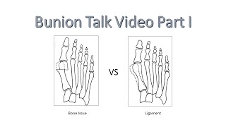 Bunion Talk Video Part 1 Bonebreaking VS NoBoneBreaking Bunion Surgery [upl. by Richma]