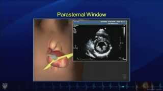 Echo Tutorial Comprehensive Transthoracic Echocardiogram  Mayo Clinic [upl. by Fen27]