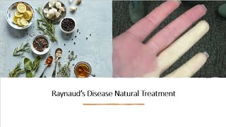 Raynauds Disease Natural Treatment [upl. by Delbert819]