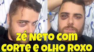 Zé Neto Surge com Corte na Cabeça e Olho Roxo [upl. by Ancalin73]