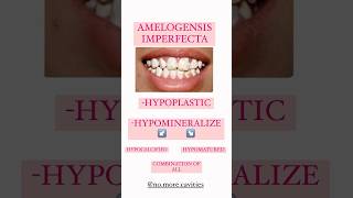 AMELOGENESIS IMPERFECTA dental anomalies enameldefects imperfecta [upl. by Ayit]