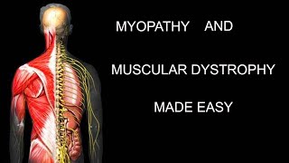 MYOPATHY AND MUSCULAR DYSTROPHY MADE EASY [upl. by Hgielhsa170]