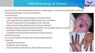 General Examination Cyanosis  Recognizing the Blue Tint  A Guide to Clinical Examination [upl. by Retnyw]