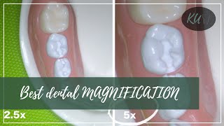 What is the IDEAL MAGNIFICATION in dentistry [upl. by Razal]