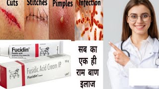 Fucidin Cream  Fucidic Acid Cream  ointment हिन्दी में Uses side effects  Honest review [upl. by Branch]