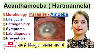 Acanthamoeba Hartmannela Parasite in Hindi  Life Cycle  Lab Diagnosis  Parasitology [upl. by Saxen]