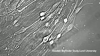 Från hudcell till nervcell direkt [upl. by Sachs]