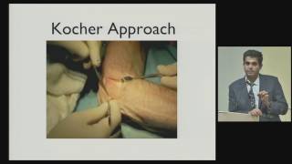 Dr Jairam Jagiasi HOD OrthopaedicsSurgical Approaches to the Elbow [upl. by Martell]