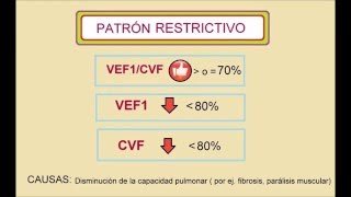 Interpretación básica de espirometría [upl. by Akem]