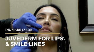 Juvederm Lips amp Smile Lines  Dr Mark Jabor [upl. by Rasure]