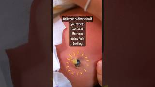 Newborn Umbilical Cord Care 👶🏽newborn [upl. by Lusar667]