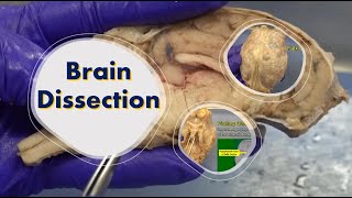 Brain Dissection [upl. by Kehoe]