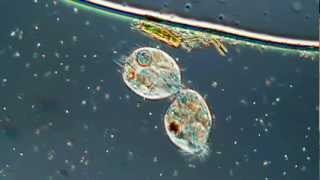 Lamour Or Cell Division in the Ciliated Protozoa Oxytricha 500X [upl. by Lorrin]