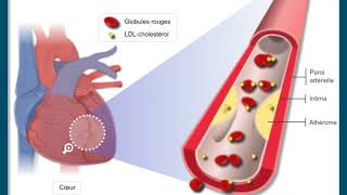 Questce que lathérosclérose [upl. by Ewall]