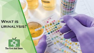 What is urinalysis [upl. by Malaspina104]