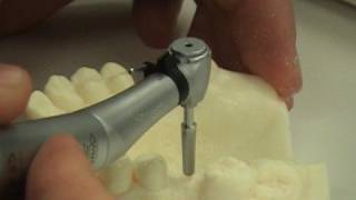 Dental implant surgery training video [upl. by Garlaand]