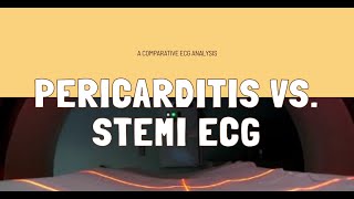 Distinguishing Pericarditis from STEMI A Comparative ECG Analysis [upl. by Rysler]