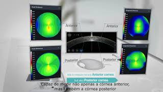 US Ophthalmic  Anterior Segment Optical Coherence Tomography HOCT Huvitz [upl. by Mulac847]