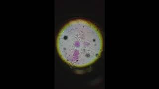 Multiple Cells Lysing at 400x [upl. by Solorac]