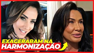 13 FAMOSOS QUE JÁ ERAM BONITOS ANTES MAS FIZERAM HARMONIZAÇÃO FACIAL 😱 [upl. by Hrutkay975]