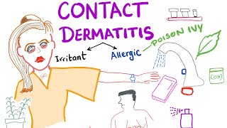 Contact Dermatitis [upl. by Sherl]