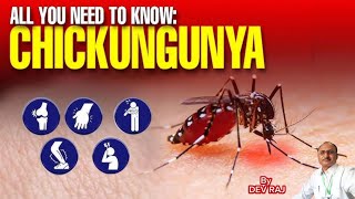 Chikungunya viral infectionFever Joint pain Mosquito 🦟 bite diseaseچکنگونیا [upl. by Admama]