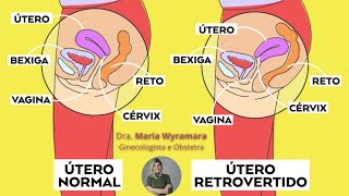 Útero RETROVERTIDO  assista e entenda o que significa [upl. by Iyre]