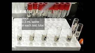 cold agglutination titer assay [upl. by Novj]